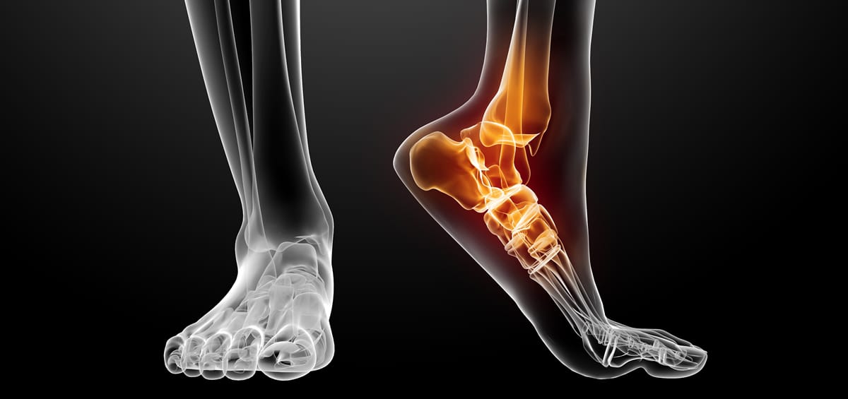 The Rehab No One’s Talking About (But You Desperately Need)
